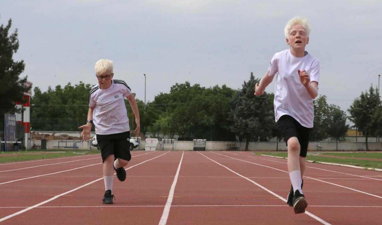  Şampiyon albino çocuklar atletizmde uluslararası başarılara odaklandı