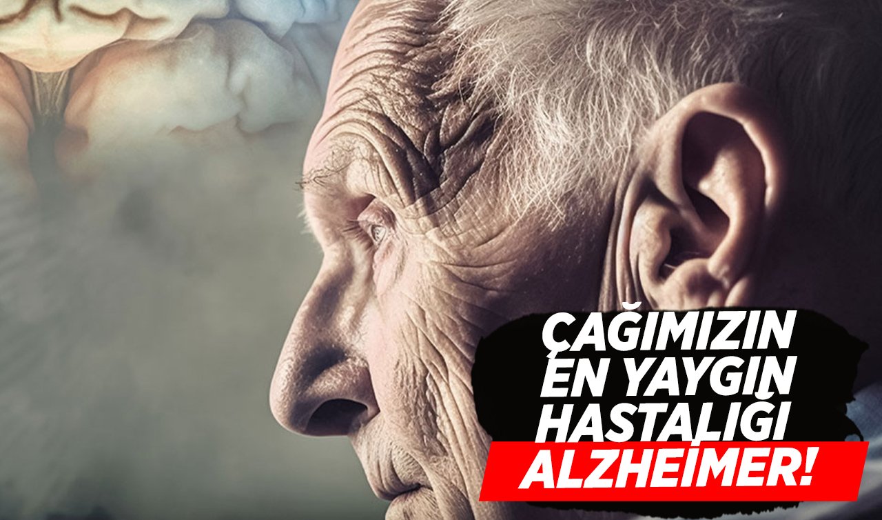  Çağımızın en yaygın hastalığı Alzheimer! Alzheimer’den korunmak için neler yapmalıyız?