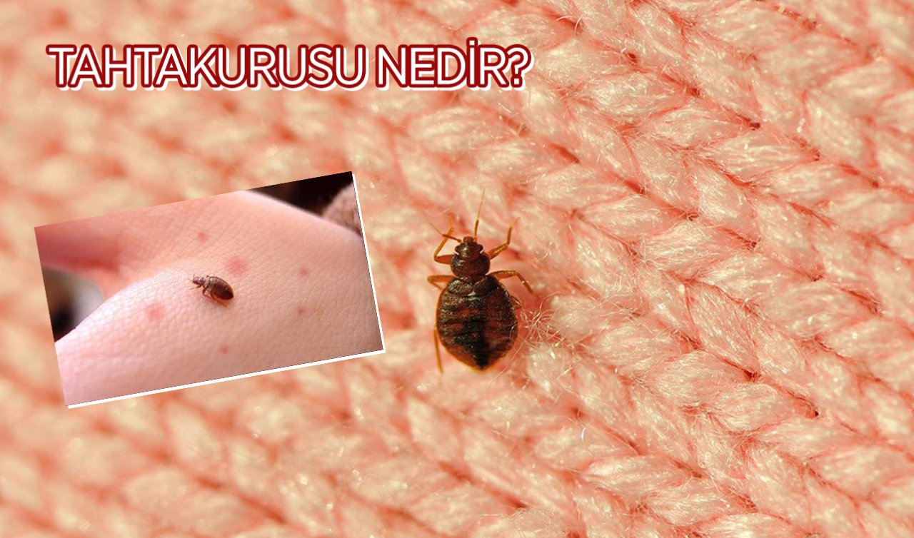  Tahtakurusu nedir? Tahtakurusu ısırığının belirtileri nelerdir? Tahtakurusu nasıl yok edilir