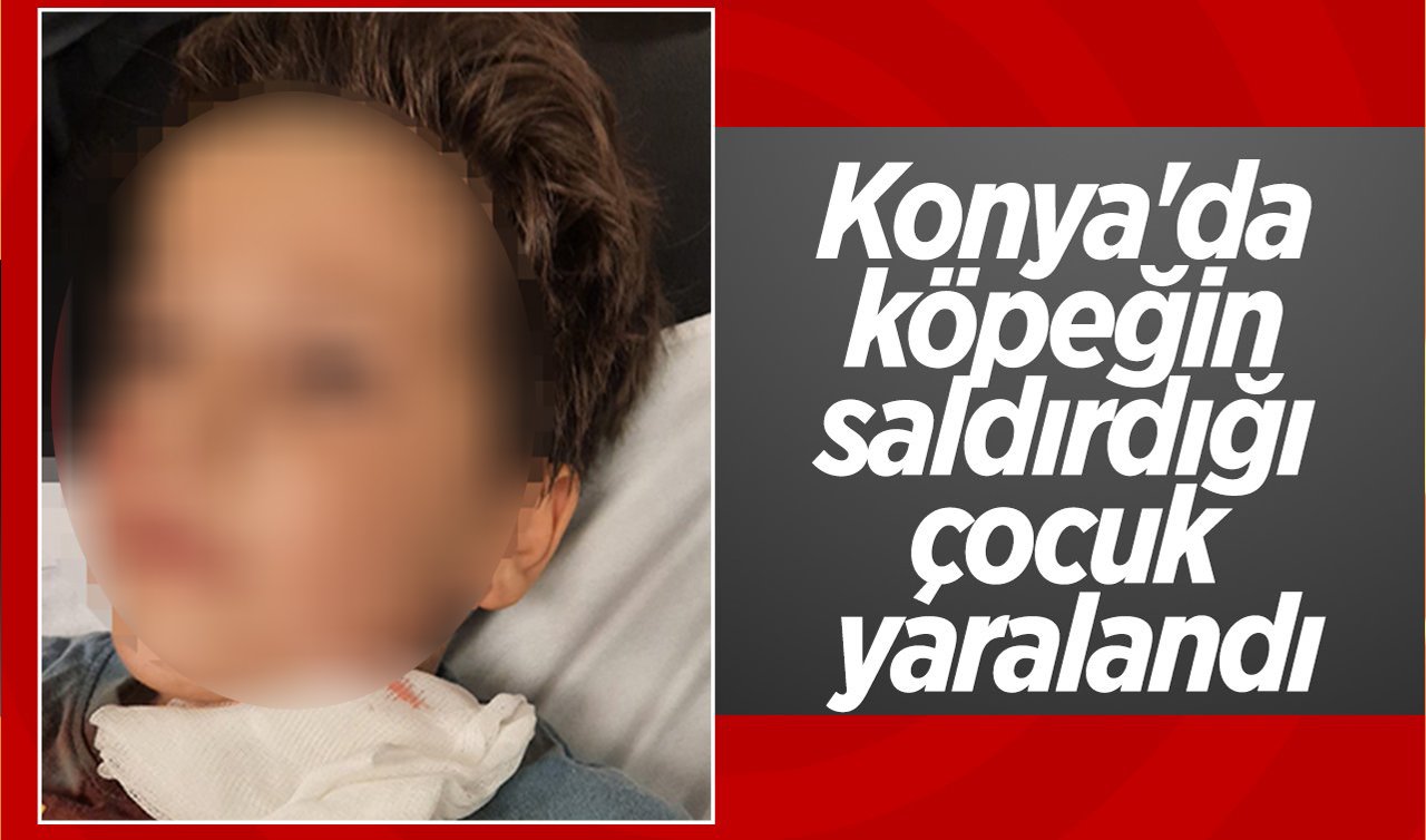  Konya’da köpeğin saldırdığı çocuk yaralandı