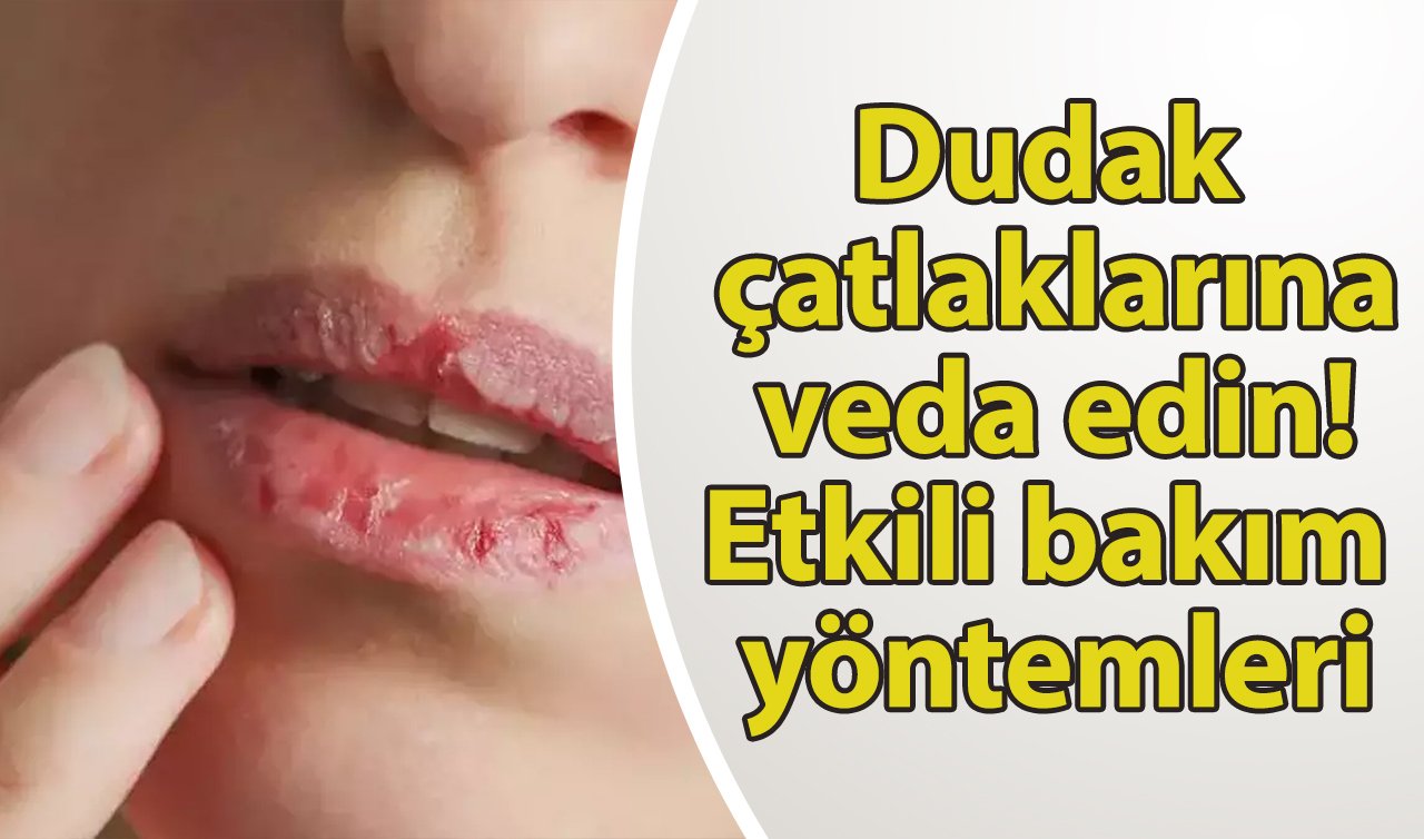 Dudak çatlaklarına ne iyi gelir? Dudak çatlakları için evde hazırlanabilecek karışımlar